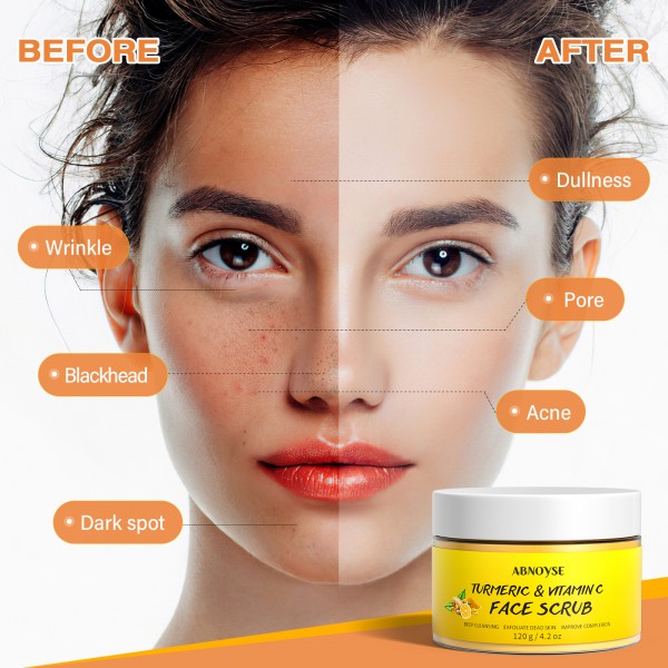 ABNOYSE Vitamin C and Turmeric Face Scrub Cream Organics Microdermabrasion Facial Scrub Brightening Exfoliating Clears Blackheads Improve Dark Spot Acne with Strawberry Extract Exfoliator